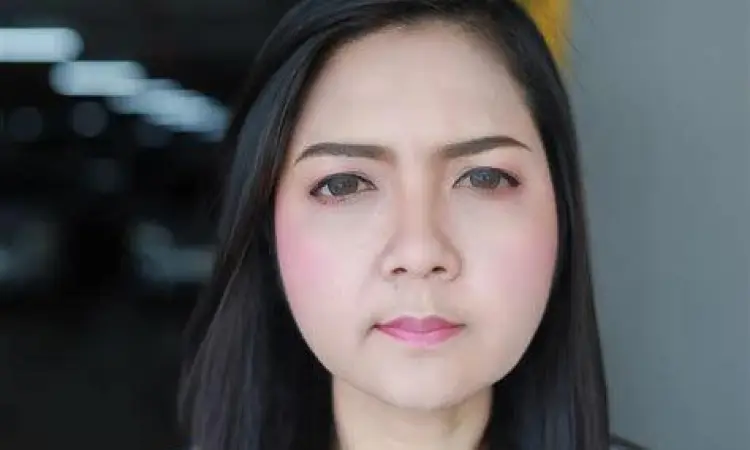 Ilustrasi perubahan fisik akibat penggunaan steroid jangka panjang