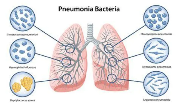 Visualisasi mikroskopis bakteri Streptococcus pneumoniae