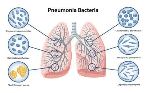 Bakteri Patogen Paru Visualisasi mikroskopis bakteri Streptococcus pneumoniae
