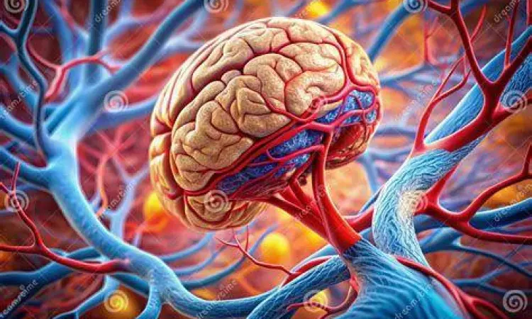 Mekanisme Terjadinya TIA Ilustrasi penyumbatan aliran darah otak pada stroke ringan