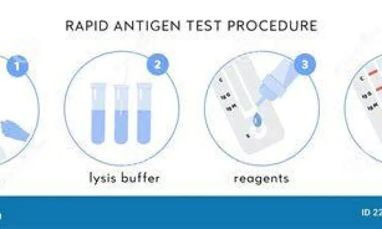Prosedur Swab Test Prosedur pengambilan sampel rapid test