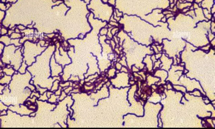 Bakteri Treponema Pallidum Mikroskopis bakteri Treponema pallidum penyebab sifilis