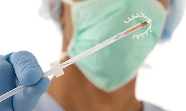 Pemasangan IUD Spiral Prosedur medis pemasangan IUD pada rahim