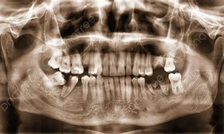 Diagnosa Radiologi Gigi Hasil rontgen panoramik untuk perencanaan behel