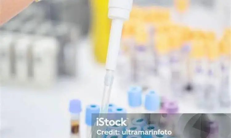 Fasilitas Laboratorium Medis Peralatan laboratorium PCR modern