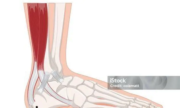 Anatomi plantar fascia pada kaki manusia