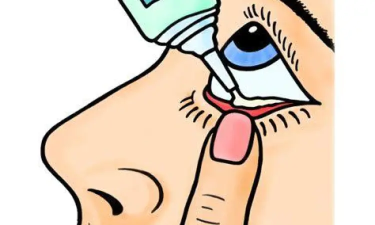 Cara mengaplikasikan salep mata dengan benar