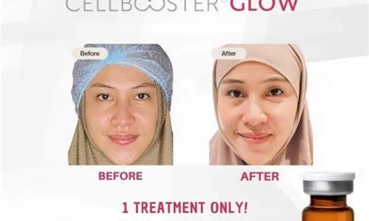 Hasil Perawatan Kulit Perubahan kulit sebelum dan sesudah perawatan rutin