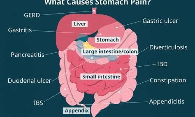 Ilustrasi gejala nyeri perut dan dispepsia