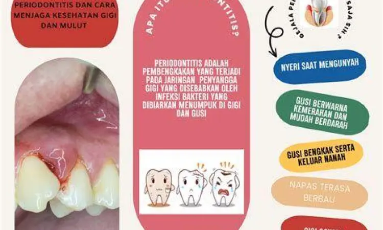 Rongga mulut yang sehat tanpa sariawan