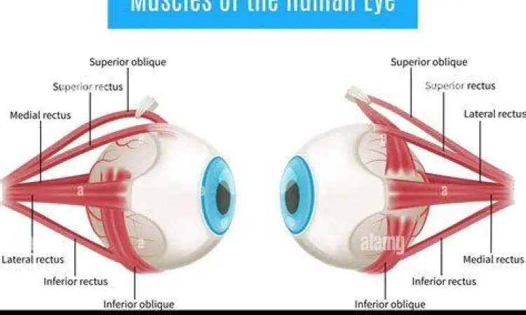 Anatomi otot di sekitar mata manusia