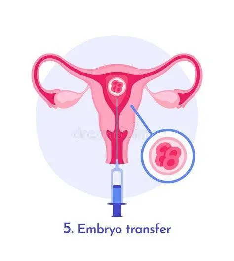 Keberhasilan Transfer Embrio Konsep transfer embrio yang sehat