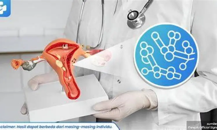 Gejala Klinis Infeksi Jamur ilustrasi infeksi jamur vagina kandidiasis