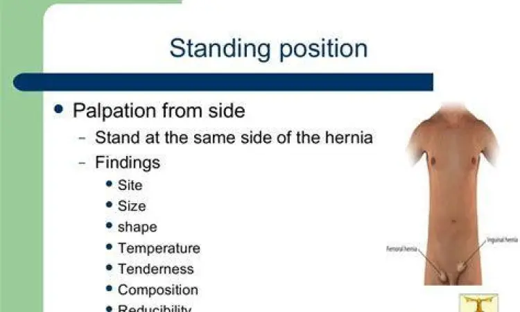Pemeriksaan Hernia Prosedur pemeriksaan hernia inguinalis