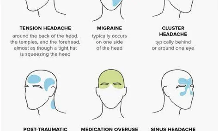 Grafik lokasi nyeri kepala berdasarkan jenisnya
