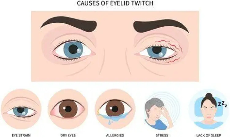 Ilustrasi stres penyebab kedutan alis