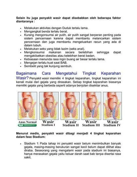 Gejala Ambeien Stadium Akhir Gejala wasir stadium 4 kronis