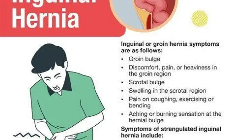 Ilustrasi rasa nyeri pada area selangkangan akibat hernia