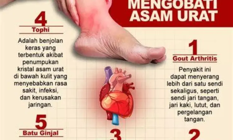Radang Sendi Gout Visualisasi radang sendi akibat kristal asam urat
