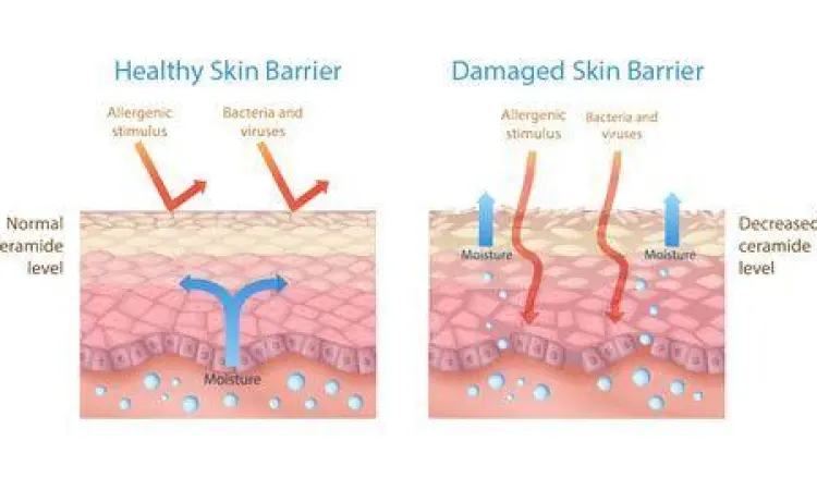 Gejala Skin Barrier Bermasalah Gejala peradangan akibat skin barrier rusak