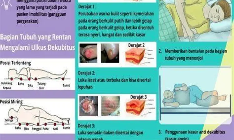 Pencegahan Luka Dekubitus Teknik miring kanan miring kiri pada pasien bed rest