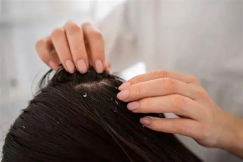 Mencuci Rambut dengan Selsun Proses mencuci rambut dengan sampo anti ketombe