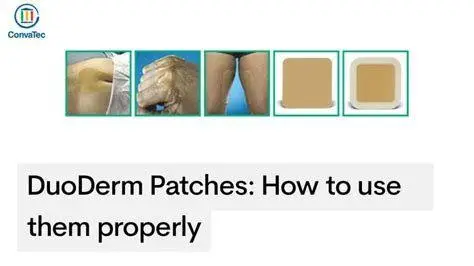 Cara Menggunakan DuoDerm Langkah aplikasi DuoDerm Extra Thin yang benar