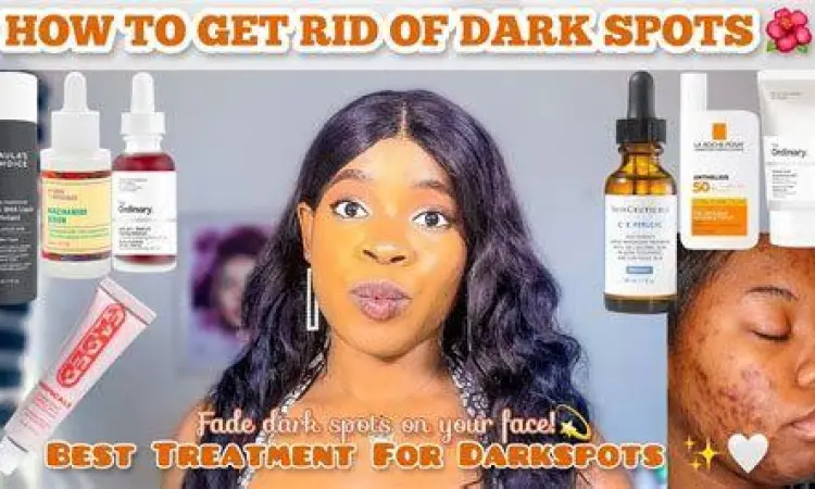 Perawatan Hiperpigmentasi Perawatan flek hitam dan hiperpigmentasi pada wajah