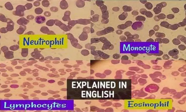 Tampilan neutrofil dan limfosit
