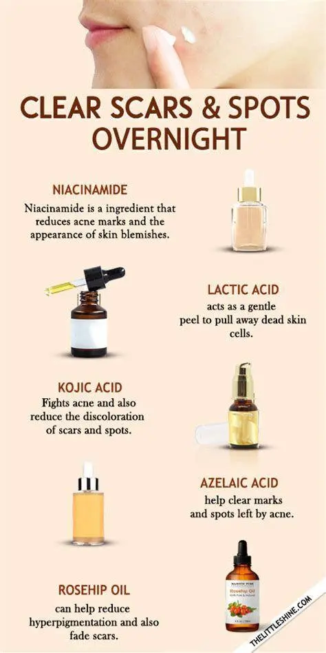 Skincare untuk Hiperpigmentasi Bahan aktif skincare untuk noda hitam