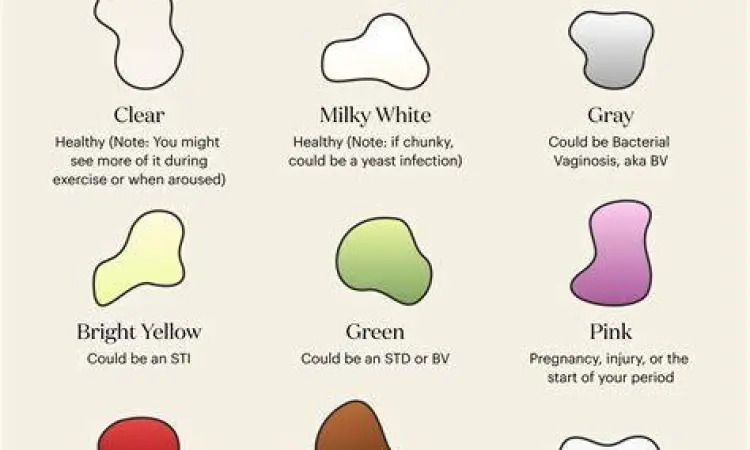 Tekstur Keputihan Abnormal perbandingan tekstur keputihan berwarna kuning