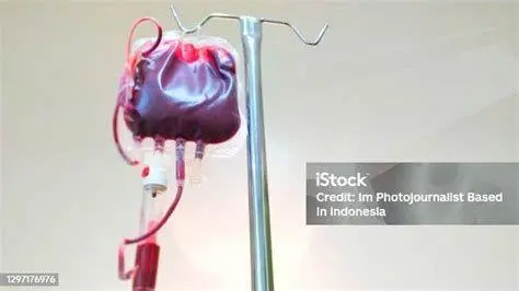 Komponen Darah Transfusi Kantong darah untuk keperluan transfusi medis