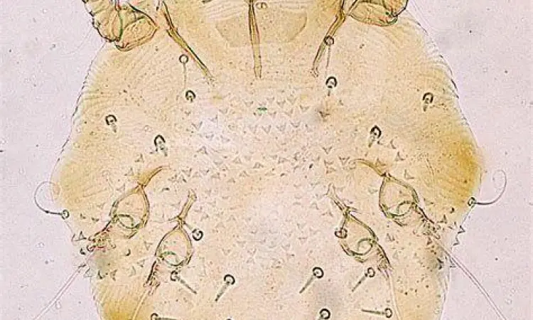 Tampilan mikroskopis tungau Sarcoptes scabiei penyebab scabies