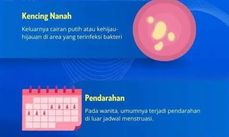 Ilustrasi gejala kencing nanah pada sistem reproduksi