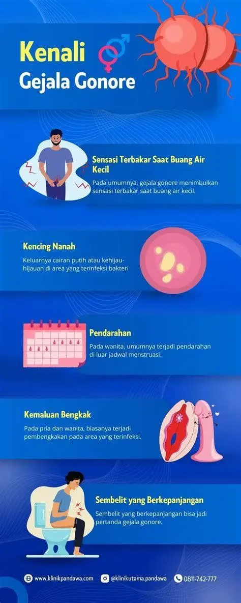 Gejala Kencing Nanah Ilustrasi gejala kencing nanah pada sistem reproduksi
