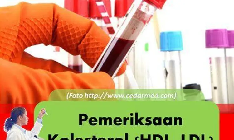 Alat Cek Kolesterol Alat cek kolesterol digital untuk penggunaan pribadi