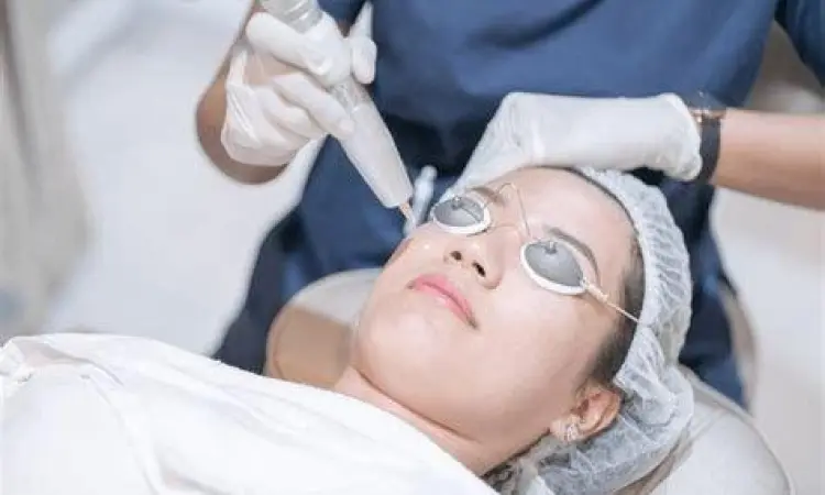 Prosedur laser pencerah wajah di klinik kecantikan