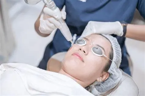 Laser Whitening Treatment Prosedur laser pencerah wajah di klinik kecantikan