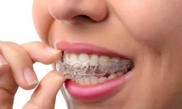 Clear Aligners Modern Alat perata gigi transparan clear aligners