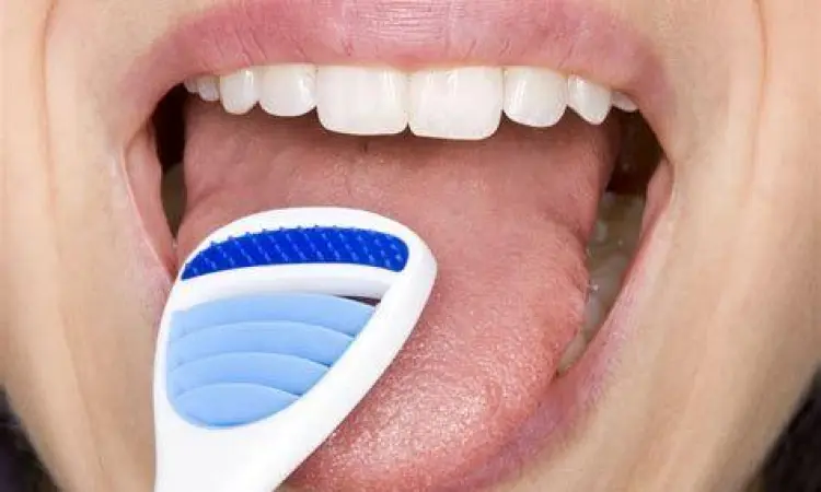 Pembersihan Lidah Cara membersihkan lidah putih dengan alat pembersih khusus