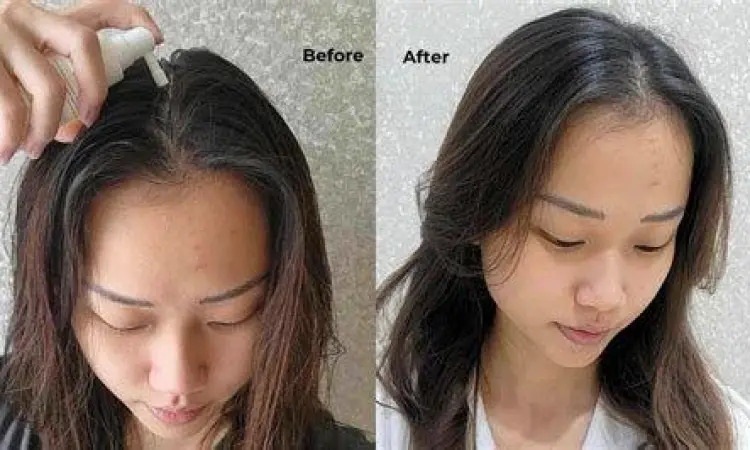 Perbandingan rambut setelah perawatan rutin dengan produk NR