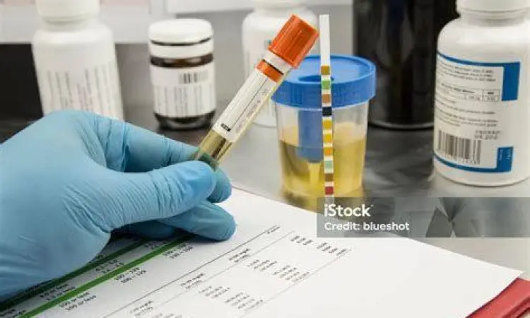 Urianlysis untuk ISK Pemeriksaan urin di laboratorium