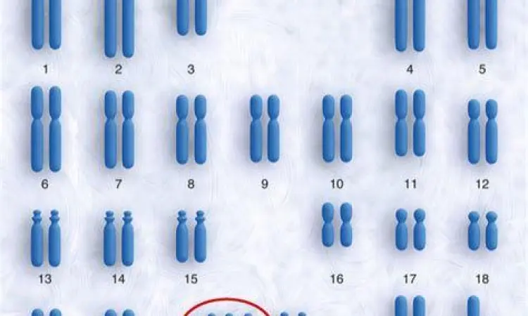 Visualisasi Genetik Trisomi 21 Diagram kromosom manusia yang menunjukkan kelebihan pada pasangan nomor 21