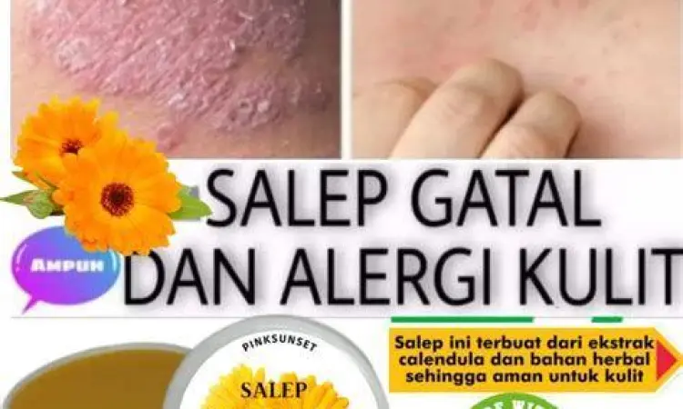 Prosedur Pengolesan Salep cara mengoleskan salep untuk bisul dengan benar