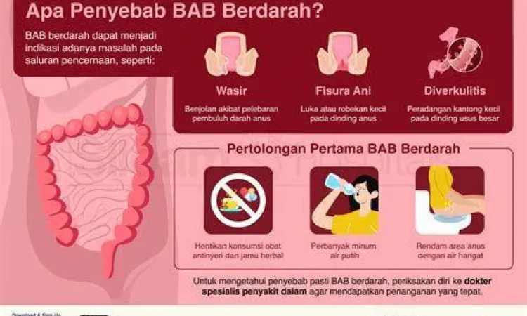 Penyebab Utama Buang Air Besar Berdarah Infografis penyebab bab berdarah secara medis