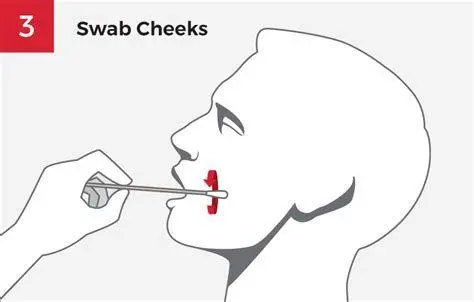 Prosedur Pengambilan Sampel Prosedur buccal swab tes dna