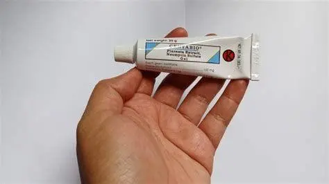 Salep Kortikosteroid Topikal Salep kortikosteroid untuk obat gatal gatal peradangan