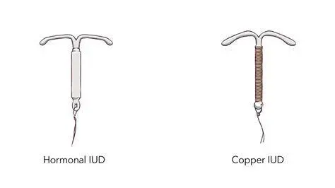 Ukuran IUD Ukuran IUD dibandingkan dengan koin