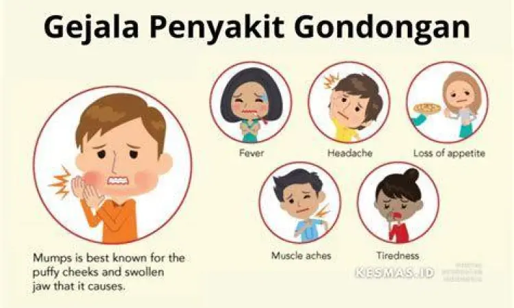 Foto gejala pembengkakan leher pada penderita gondongan
