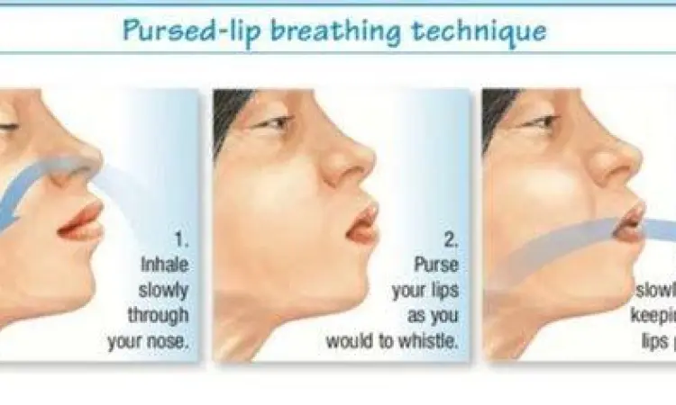 Ilustrasi teknik pernapasan pursed lip breathing